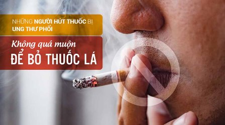 Hút thuốc lá gây ung thư nhiều bộ phận